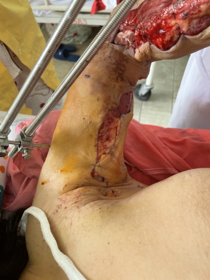 Một trường hợp cần giúp đỡ