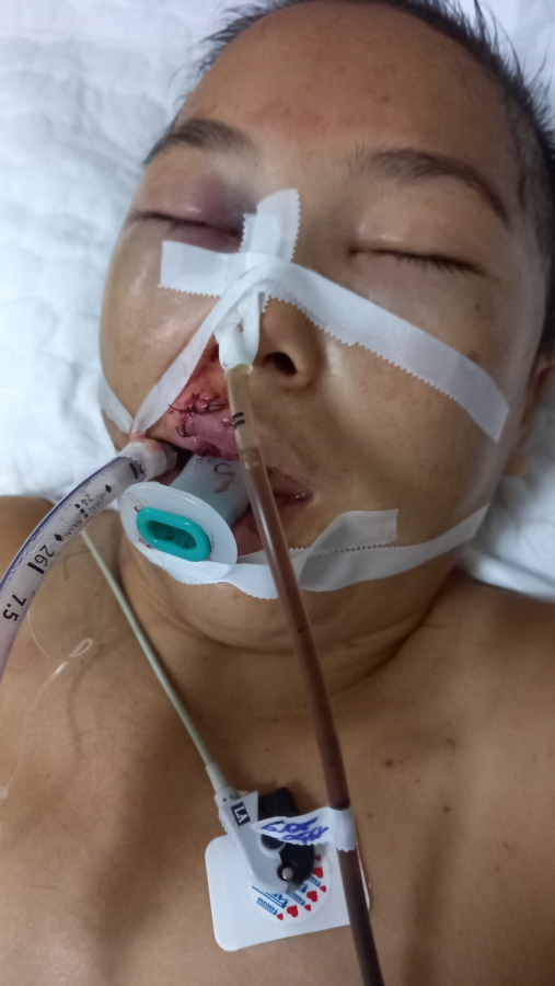 Xin giúp đỡ mẹ đơn thân hôn mê sâu vì tai nạn giao thông