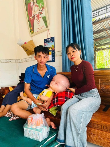 Kêu gọi kinh phí giúp mua sữa cho cháu Bảo Nhi - bị bệnh Thủy úng não